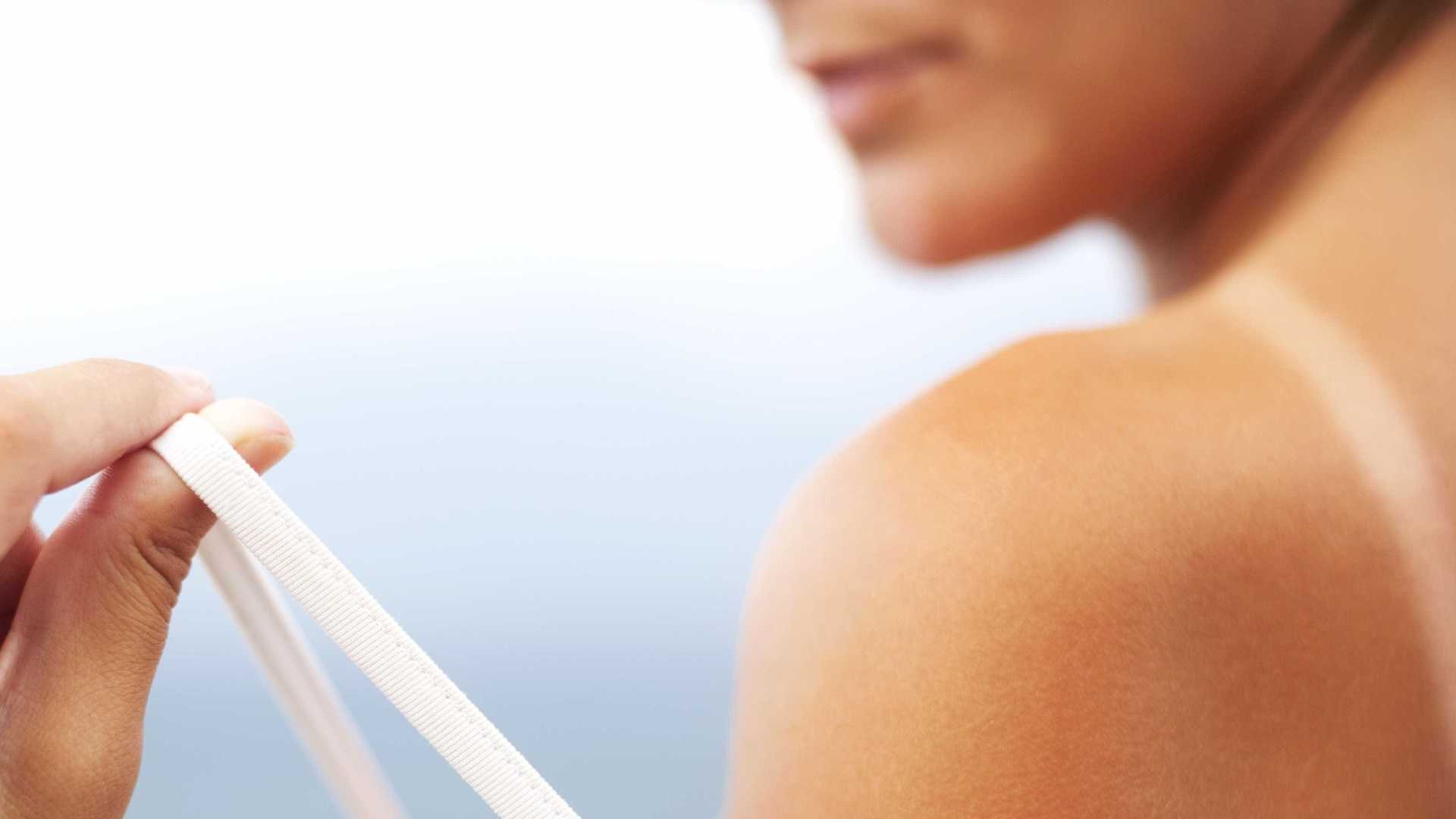 Verão: Dermatologista dá 5 dicas para quando a pele começar a descascar