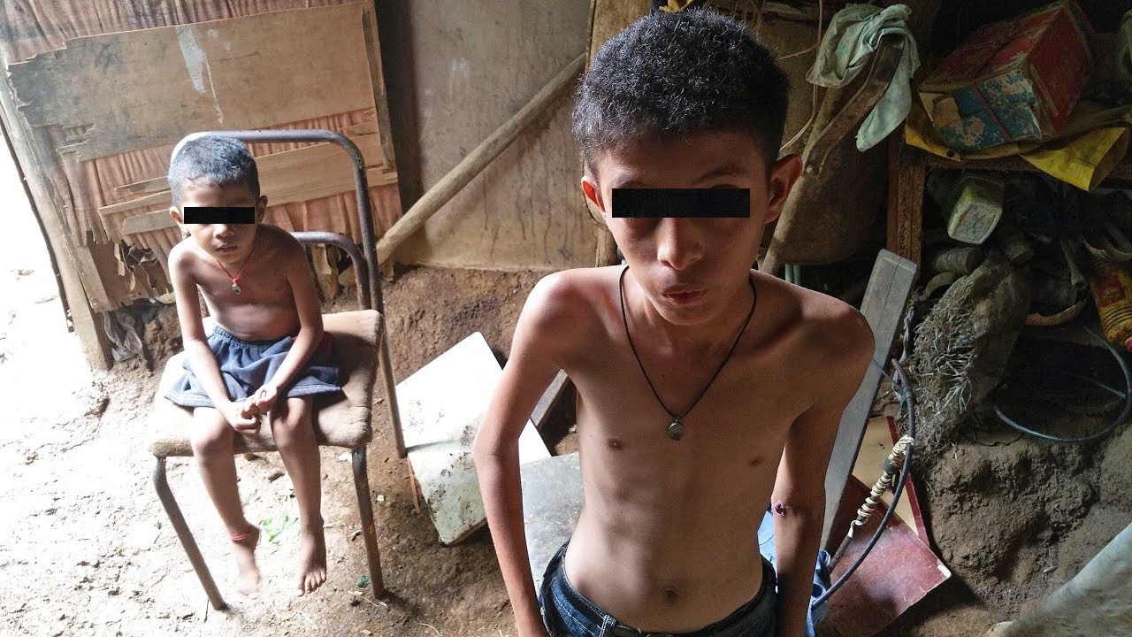 Venezuela: O paraíso socialista prossegue fazendo vítimas a desnutrição continua avançando Venezuela: O paraíso socialista prossegue fazendo vítimas a desnutrição continua avançando