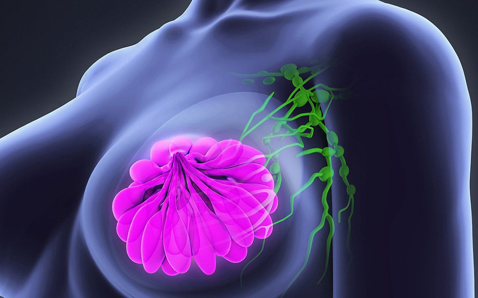 Pesquisadores decifram assinatura genética do câncer de mama