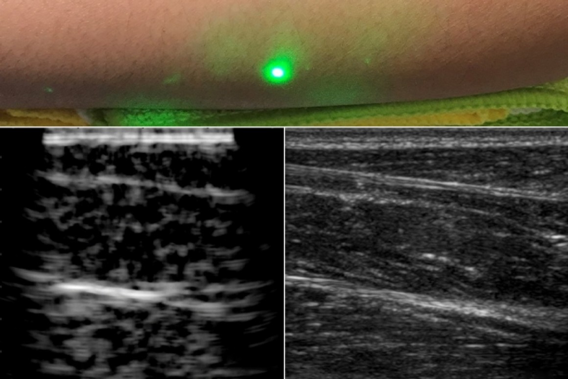 Primeiras imagens tiradas do corpo humano com ultrassom a laser