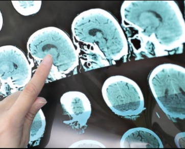Ciência: Cérebro pode manter-se ativo após a morte, diz estudo