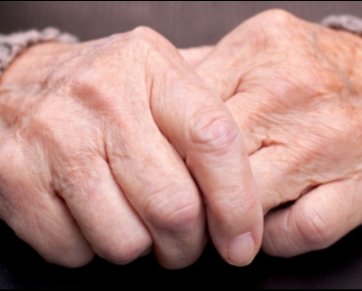 Doença: Mal de Parkinson: 10 coisas que você precisa saber sobre a doença